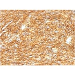 Immunohistochemistry - Anti-TMEM16A Antibody [DG1/1485] (A249699) - Antibodies.com