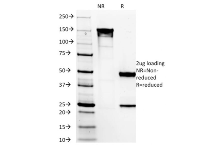 SDS-PAGE - Anti-TMEM16A Antibody [DG1/1485] (A249699) - Antibodies.com