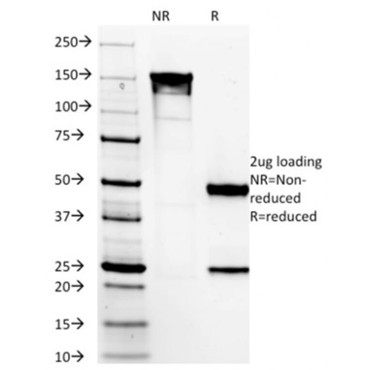 SDS-PAGE - Anti-TMEM16A Antibody [DG1/1485] (A249699) - Antibodies.com