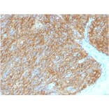 Immunohistochemistry - Anti-TMEM16A Antibody [DG1/1486] (A249700) - Antibodies.com