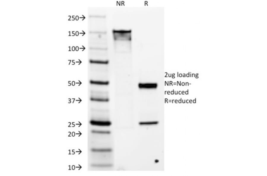 SDS-PAGE - Anti-TMEM16A Antibody [DG1/1486] (A249700) - Antibodies.com