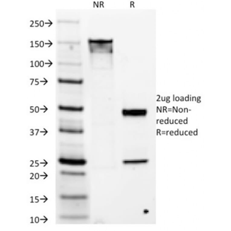 SDS-PAGE - Anti-TMEM16A Antibody [DG1/1486] (A249700) - Antibodies.com