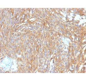 Immunohistochemistry - Anti-TMEM16A Antibody [DG1/2564R] (A249701) - Antibodies.com