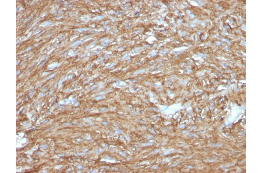 Immunohistochemistry - Anti-TMEM16A Antibody [DG1/2831R] (A249702) - Antibodies.com