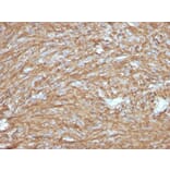 Immunohistochemistry - Anti-TMEM16A Antibody [DG1/2831R] (A249702) - Antibodies.com