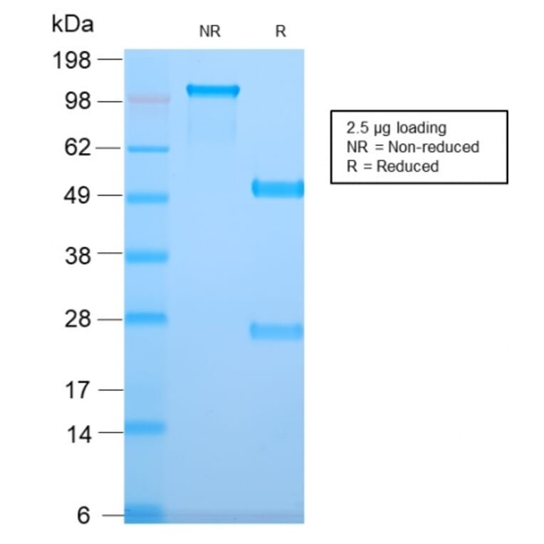 SDS-PAGE - Anti-TMEM16A Antibody [DG1/2831R] (A249703) - Antibodies.com