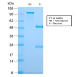 SDS-PAGE - Anti-TMEM16A Antibody [DG1/2831R] (A249703) - Antibodies.com