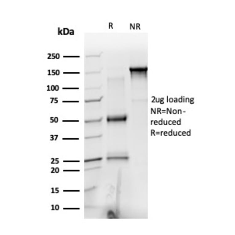 SDS-PAGE - Anti-PRMT6 Antibody [PCRP-PRMT6-2C9] (A249704) - Antibodies.com