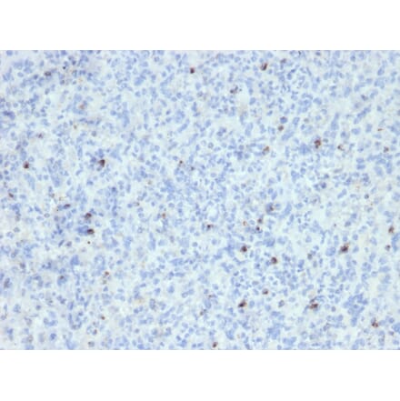 Immunohistochemistry - Anti-Perforin Antibody [SPM434] (A249710) - Antibodies.com
