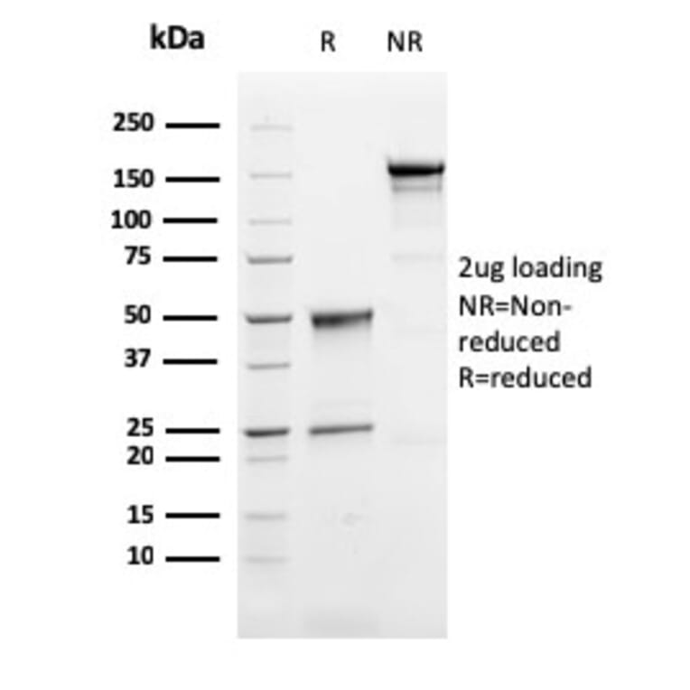 SDS-PAGE - Anti-Perforin Antibody [PRF1/2468] (A249712) - Antibodies.com