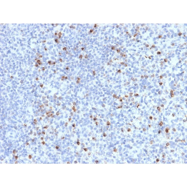 Immunohistochemistry - Anti-Perforin Antibody [PRF1/2470] (A249713) - Antibodies.com