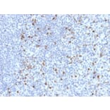 Immunohistochemistry - Anti-Perforin Antibody [PRF1/2470] (A249713) - Antibodies.com