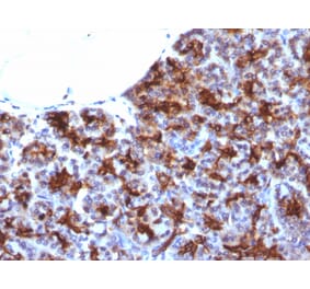 Immunohistochemistry - Anti-MAML3 Antibody [MAML3/1303] (A249714) - Antibodies.com