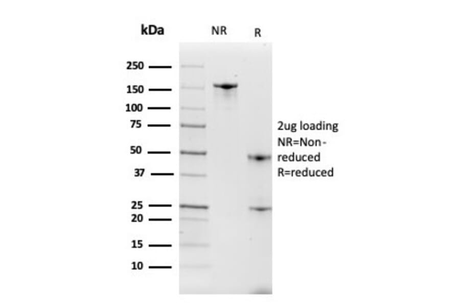 SDS-PAGE - Anti-Intelectin 1 Antibody [ITLN1/4063] (A249717) - Antibodies.com