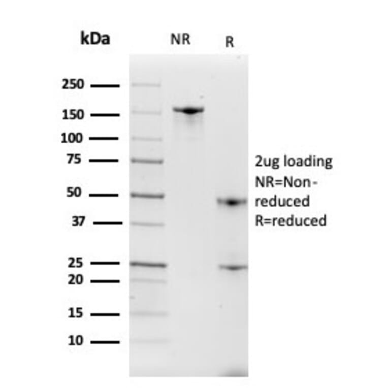 SDS-PAGE - Anti-Intelectin 1 Antibody [ITLN1/4063] (A249717) - Antibodies.com