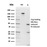 SDS-PAGE - Anti-Intelectin 1 Antibody [ITLN1/4063] (A249717) - Antibodies.com