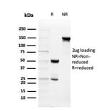 SDS-PAGE - Anti-Intelectin 1 Antibody [ITLN1/4065] (A249719) - Antibodies.com