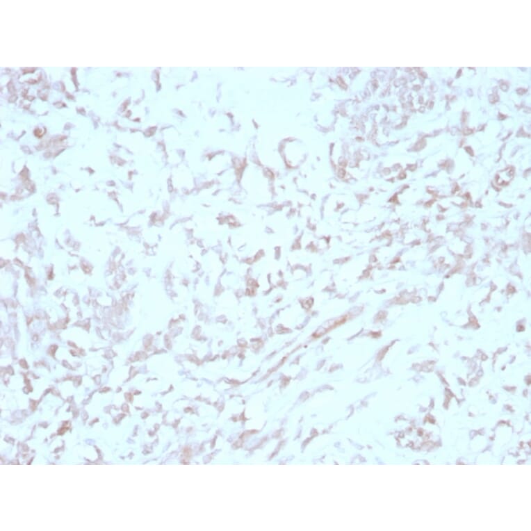 Immunohistochemistry - Anti-Kindlin 1 Antibody [4A5.14] (A249720) - Antibodies.com