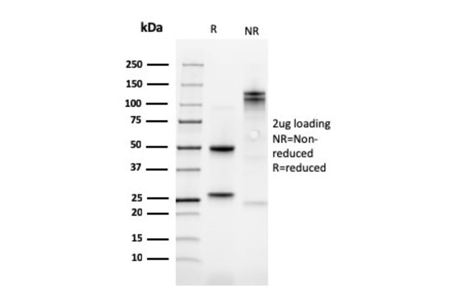 SDS-PAGE - Anti-Kindlin 1 Antibody [4A5.14] (A249721) - Antibodies.com