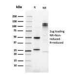 SDS-PAGE - Anti-Kindlin 1 Antibody [4A5.14] (A249721) - Antibodies.com