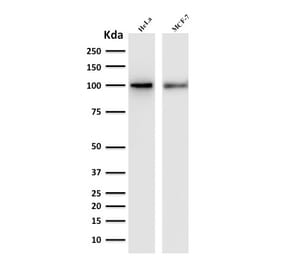 Western Blot - Anti-ENAH Antibody [ENAH/1988] (A249723) - Antibodies.com