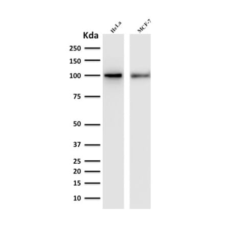 Western Blot - Anti-ENAH Antibody [ENAH/1988] (A249723) - Antibodies.com