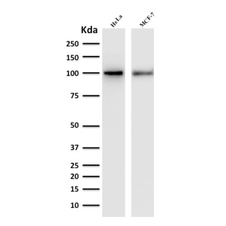 Western Blot - Anti-ENAH Antibody [ENAH/1988] (A249723) - Antibodies.com