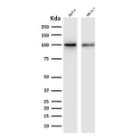 Western Blot - Anti-ENAH Antibody [ENAH/1988] (A249723) - Antibodies.com