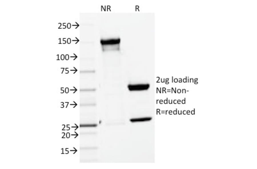 SDS-PAGE - Anti-ENAH Antibody [ENAH/1988] (A249723) - Antibodies.com