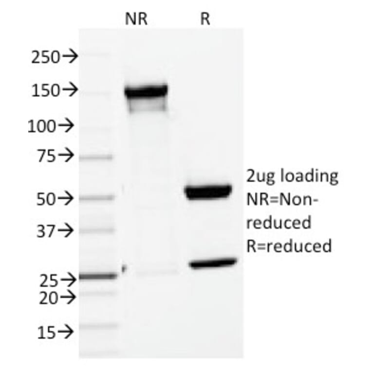 SDS-PAGE - Anti-ENAH Antibody [ENAH/1988] (A249723) - Antibodies.com
