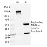 SDS-PAGE - Anti-ENAH Antibody [ENAH/1988] (A249723) - Antibodies.com