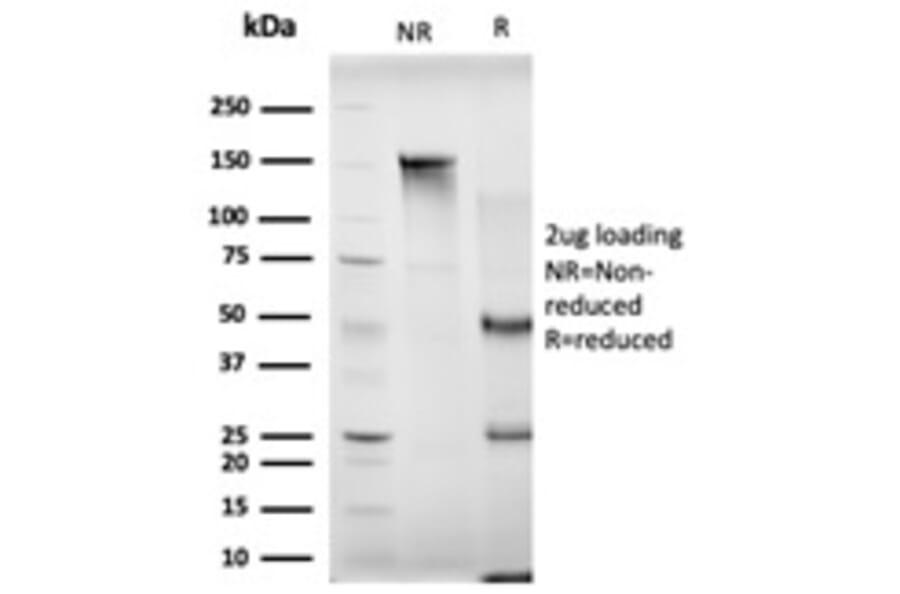 SDS-PAGE - Anti-MBNL3 Antibody [PCRP-MBNL3-1D11] (A249725) - Antibodies.com