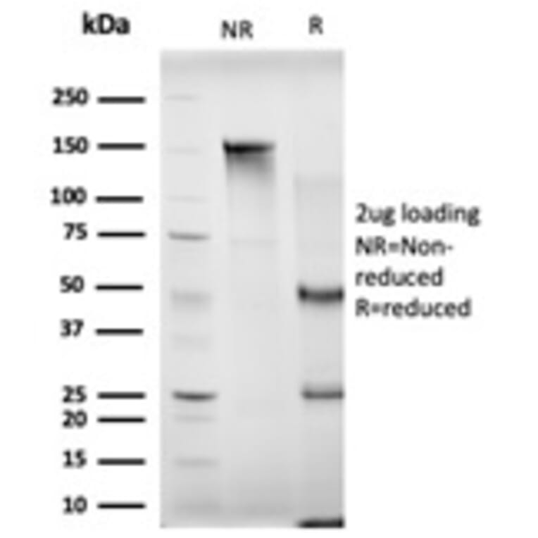 SDS-PAGE - Anti-MBNL3 Antibody [PCRP-MBNL3-1D11] (A249725) - Antibodies.com