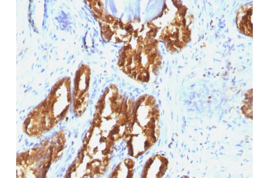 Immunohistochemistry - Anti-Prostate Specific Acid Phosphatase Antibody [ACPP/1338] (A252939) - Antibodies.com