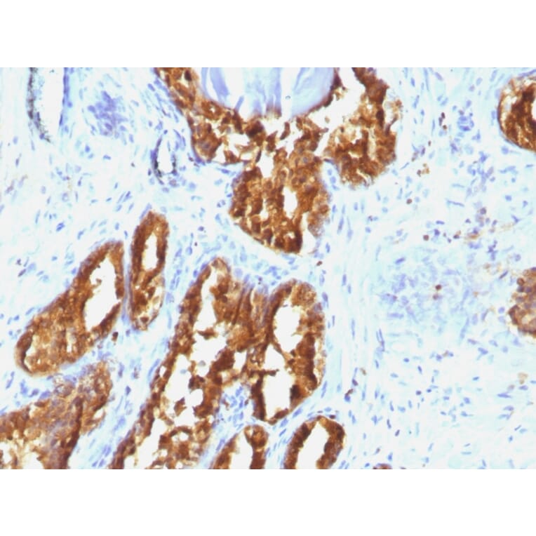 Immunohistochemistry - Anti-Prostate Specific Acid Phosphatase Antibody [ACPP/1338] (A252939) - Antibodies.com
