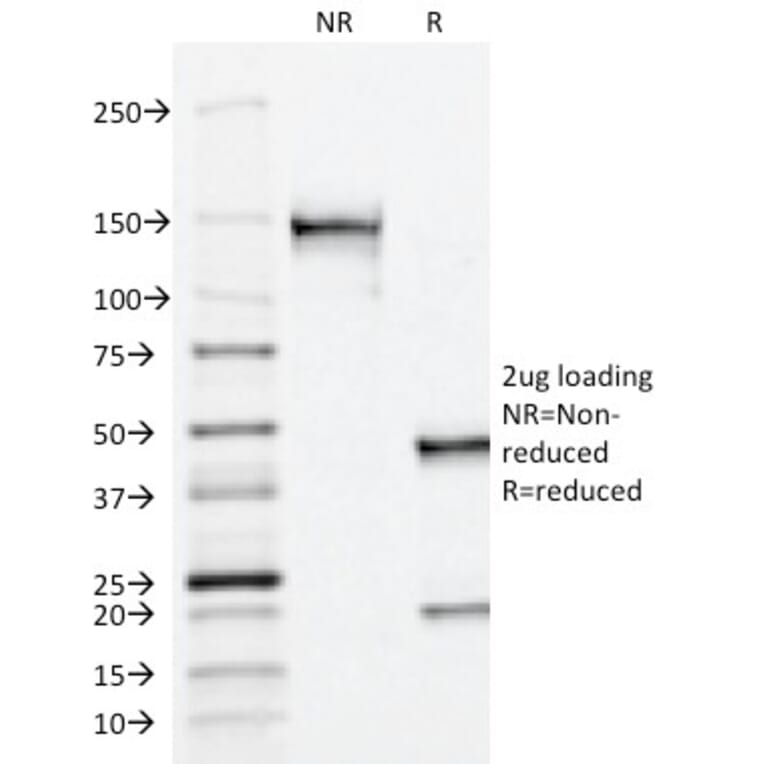 SDS-PAGE - Anti-Prostate Specific Acid Phosphatase Antibody [ACPP/1338] (A252923) - Antibodies.com