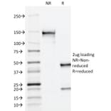 SDS-PAGE - Anti-Prostate Specific Acid Phosphatase Antibody [ACPP/1338] (A252923) - Antibodies.com
