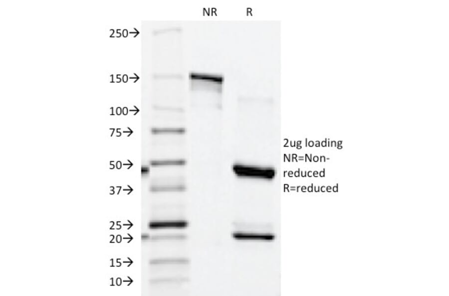 SDS-PAGE - Anti-Prostate Specific Acid Phosphatase Antibody [ACPP/1339] (A249726) - Antibodies.com