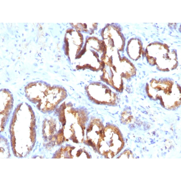 Immunohistochemistry - Anti-Prostate Specific Acid Phosphatase Antibody [PASE/4LJ] (A249727) - Antibodies.com