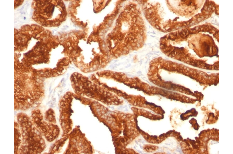 Immunohistochemistry - Anti-Prostate Specific Acid Phosphatase Antibody [SPM312] (A249728) - Antibodies.com