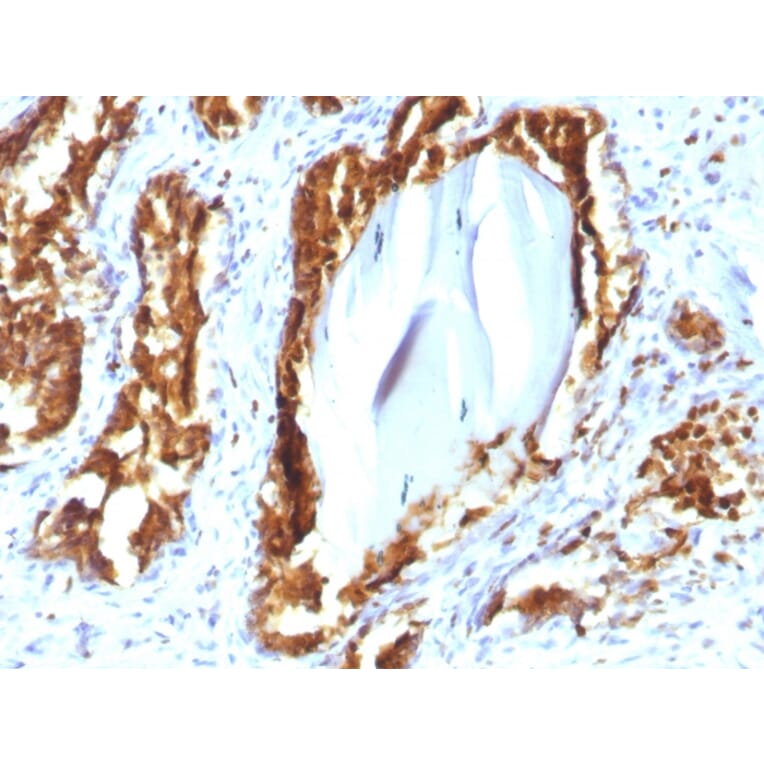 Immunohistochemistry - Anti-Prostate Specific Acid Phosphatase Antibody [rACPP/1338] (A252908) - Antibodies.com