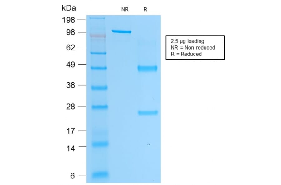 SDS-PAGE - Anti-Prostate Specific Acid Phosphatase Antibody [rACPP/1338] (A252907) - Antibodies.com