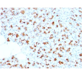Immunohistochemistry - Anti-BARX1 Antibody [BARX1/2759] (A249731) - Antibodies.com