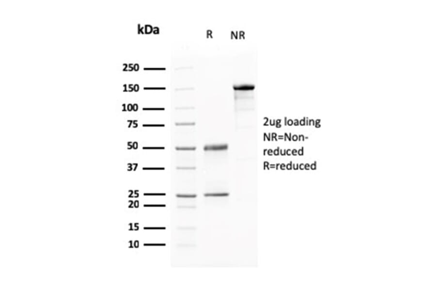 SDS-PAGE - Anti-BARX1 Antibody [BARX1/2760] (A249732) - Antibodies.com