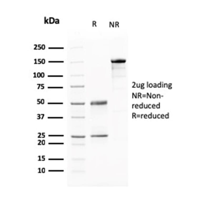 SDS-PAGE - Anti-BARX1 Antibody [BARX1/2760] (A249732) - Antibodies.com