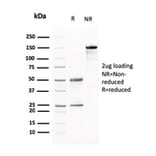 SDS-PAGE - Anti-BARX1 Antibody [BARX1/2760] (A249732) - Antibodies.com