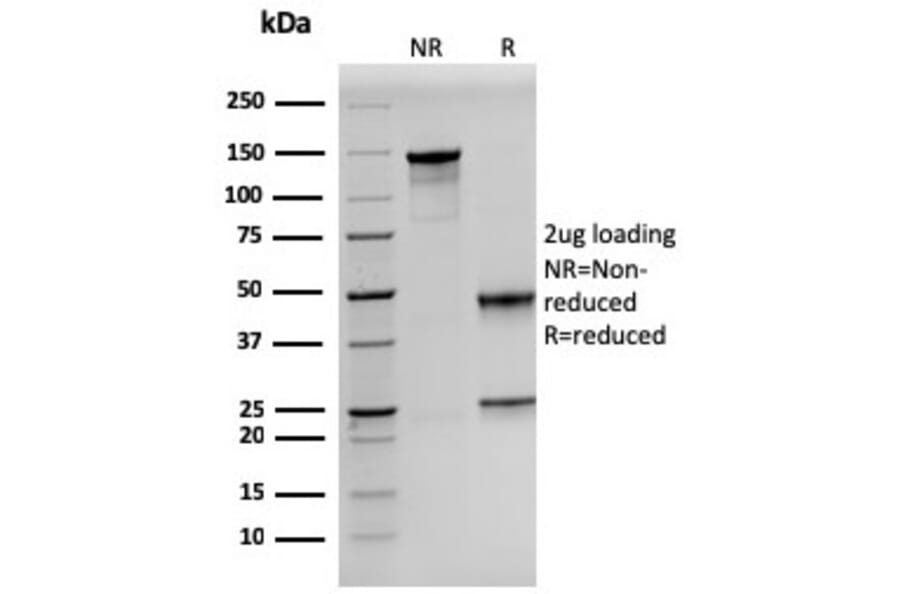 SDS-PAGE - Anti-Prolactin Antibody [PRL/2641] (A249733) - Antibodies.com