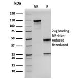 SDS-PAGE - Anti-Prolactin Antibody [PRL/2641] (A249733) - Antibodies.com