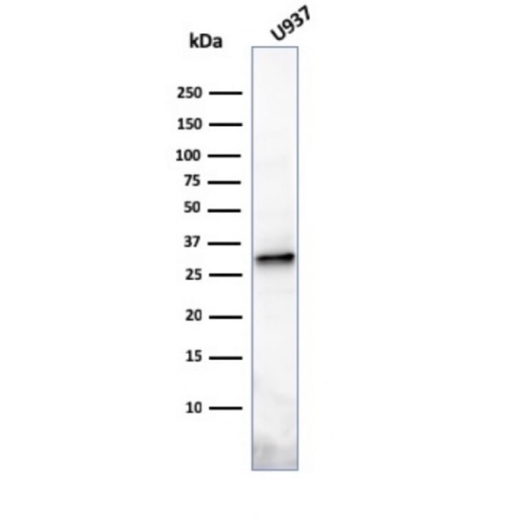 Western Blot - Anti-Prolactin Antibody [PRL/2641] (A249733) - Antibodies.com