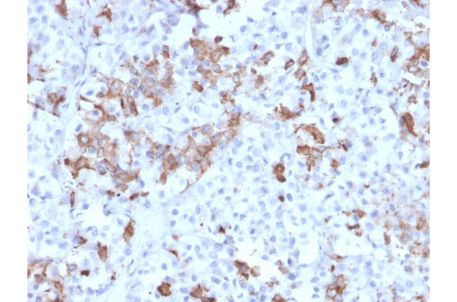 Immunohistochemistry - Anti-Prolactin Antibody [PRL/2642] (A249734) - Antibodies.com